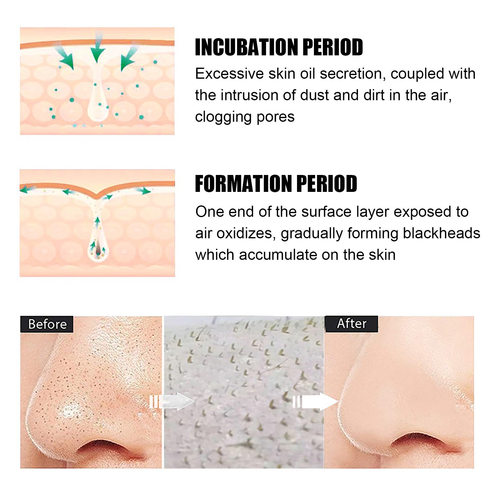 Blackhead Removal Tear And Pull Nasal Membrane Deep Cleansing Pores