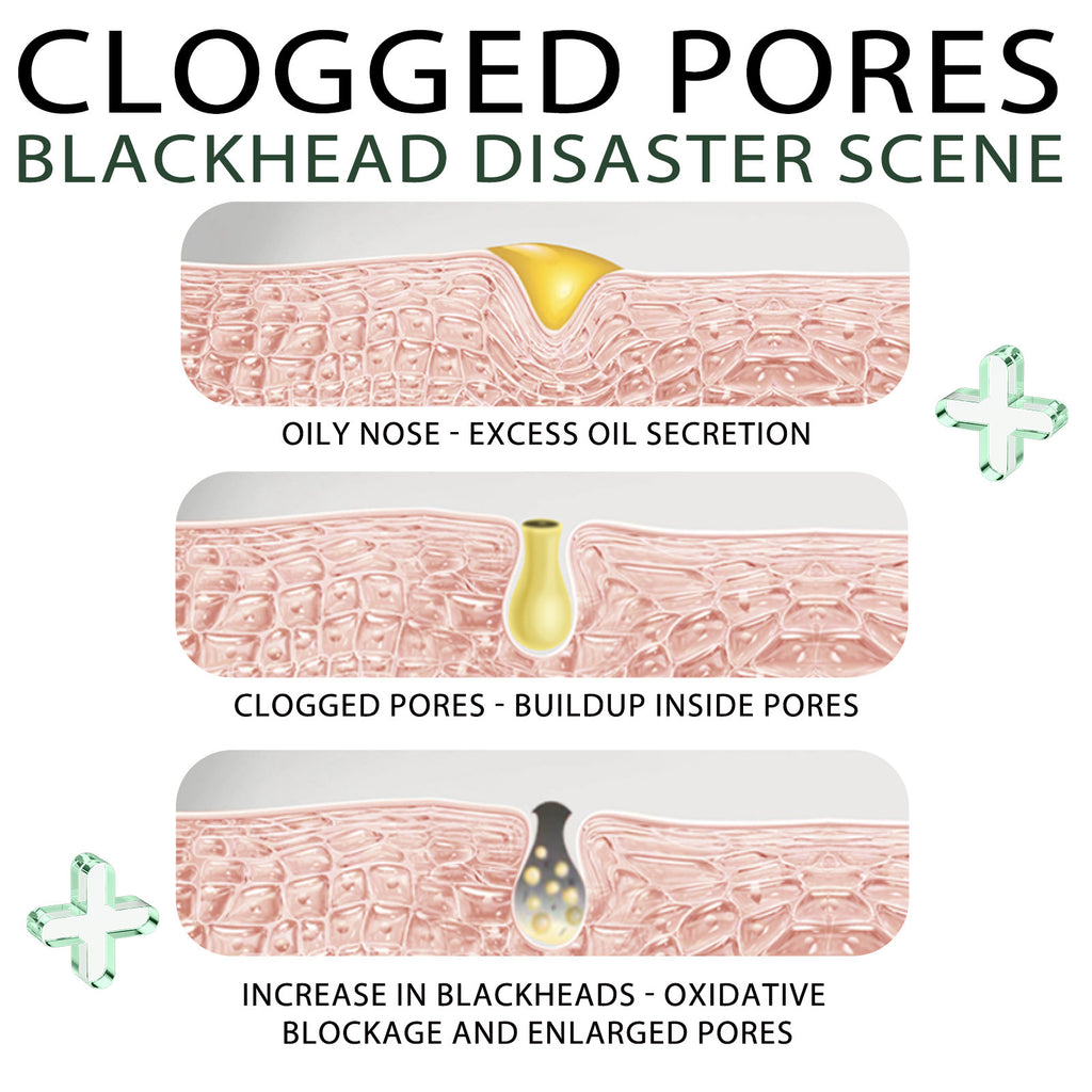 Blackhead Removal Tear And Pull Nasal Membrane Deep Cleansing Pores