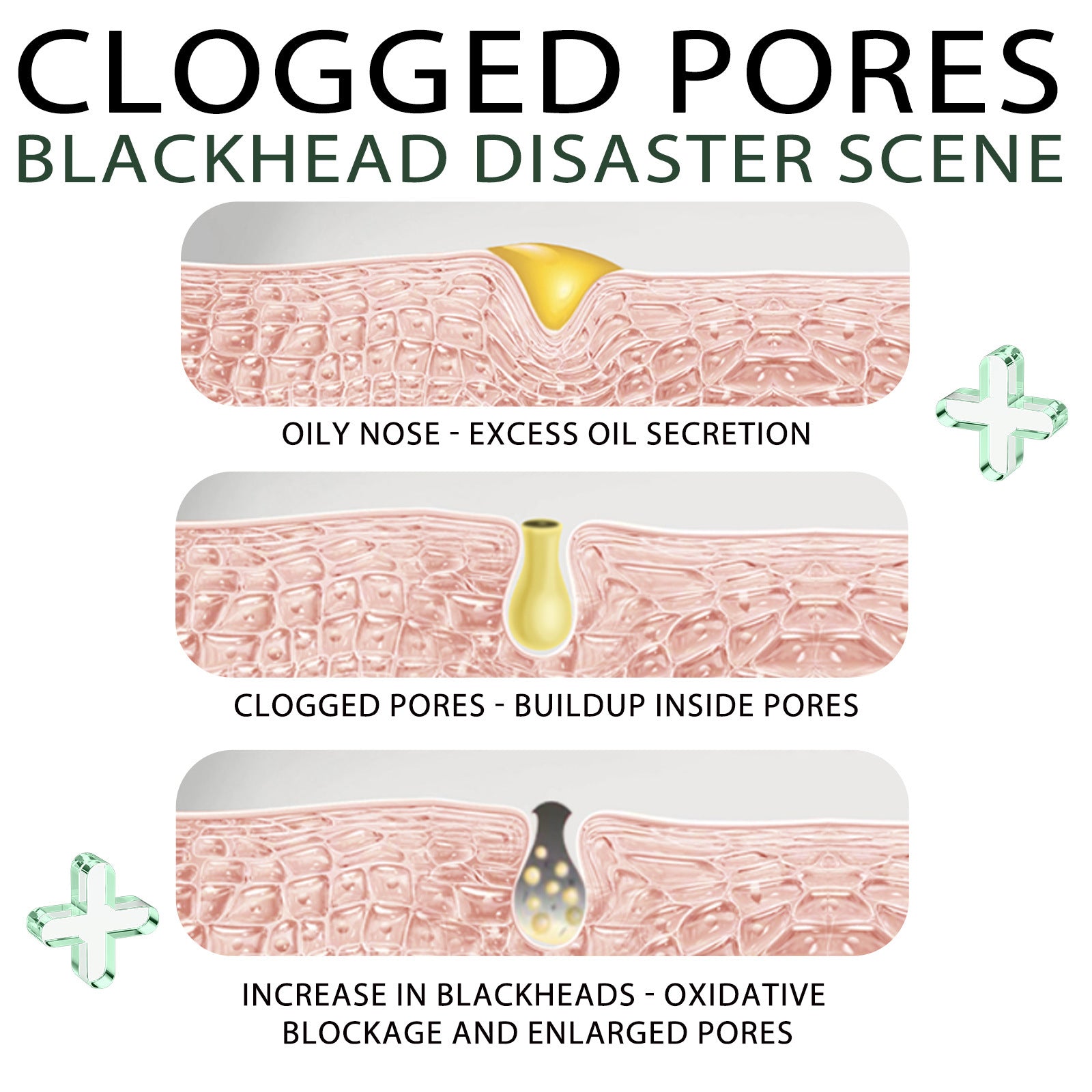 Blackhead Removal Tear And Pull Nasal Membrane Deep Cleansing Pores